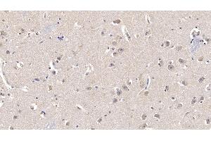 Detection of FGF13 in Human Cerebrum Tissue using Monoclonal Antibody to Fibroblast Growth Factor 13 (FGF13) (FGF13 anticorps  (AA 108-227))
