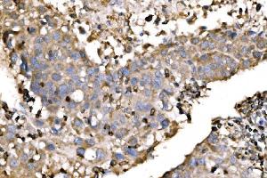 IHC analysis of EVL using anti-EVL antibody (ABIN7600986). (EVL anticorps  (AA 268-400))