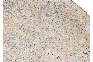 IHC analysis of Ezrin/EZR using anti-Ezrin/EZR antibody (ABIN7603214). (Ezrin anticorps  (N-Term))