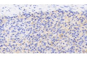 Detection of CD40L in Porcine Spleen Tissue using Polyclonal Antibody to Cluster Of Differentiation 40 Ligand (CD40L)
