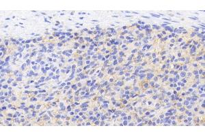 Detection of CD40L in Porcine Spleen Tissue using Polyclonal Antibody to Cluster Of Differentiation 40 Ligand (CD40L) (CD40 Ligand anticorps  (AA 111-261))