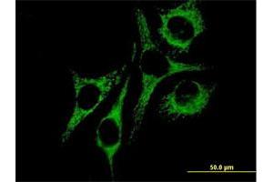 Immunofluorescence of purified MaxPab antibody to HSPD1 on HeLa cell.