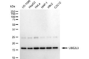 Western blotting analysis using UBE2L3 antibody (ABIN7800748).