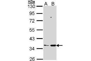 WB Image Sample (30 ug of whole cell lysate) A: 293T B: Molt-4 , 10% SDS PAGE antibody diluted at 1:1000 (PTGES2 anticorps)
