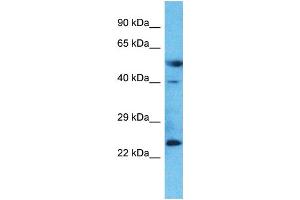 Host:  Rabbit  Target Name:  LAMP5  Sample Type:  Placenta lysates  Antibody Dilution:  1. (LAMP5 anticorps  (Middle Region))