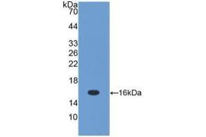 Detection of Recombinant TGFb1, Mouse using Polyclonal Antibody to Transforming Growth Factor Beta 1 (TGFb1) (TGFB1 anticorps  (AA 279-390))
