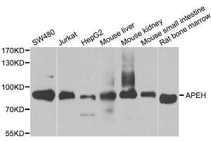 Western blot analysis of extracts of various cell lines, using APEH antibody. (APEH anticorps  (AA 1-260))