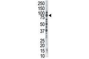 Image no. 1 for anti-SMAD Specific E3 Ubiquitin Protein Ligase 1 (SMURF1) (C-Term) antibody (ABIN357470)