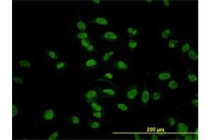 Immunofluorescence of monoclonal antibody to CMAS on HeLa cell. (CMAS anticorps  (AA 164-263))