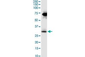 STC2 monoclonal antibody (M08), clone 2B11. (Stanniocalcin 2 anticorps  (AA 1-302))