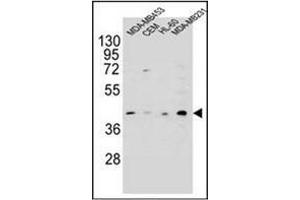 Western blot analysis of HHLA2 Antibody (N-term) in MDA-MB453, CEM, HL-60, MDA-MB231 cell line lysates (35ug/lane).
