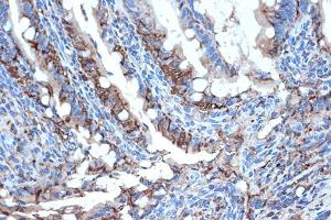 Immunohistochemistry of paraffin-embedded rat intestine using FABPI Rabbit mAb (ABIN7267151) at dilution of 1:100 (40x lens).
