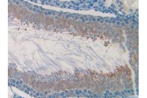 Detection of CHRM1 in Rat Testis Tissue using Polyclonal Antibody to Cholinergic Receptor, Muscarinic 1 (CHRM1)