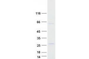 Validation with Western Blot