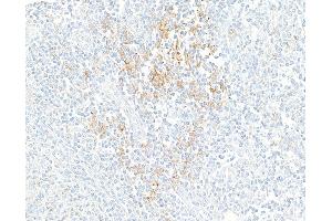 Immunohistochemistry (IHC) image for anti-CD274 (PD-L1) (C-Term) antibody (ABIN7454042) (Recombinant PD-L1 anticorps  (C-Term))