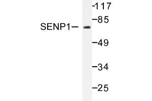 Image no. 1 for anti-SUMO1/sentrin Specific Peptidase 1 (SENP1) antibody (ABIN271955) (SENP1 anticorps)