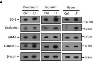 The effects of L. (Occludin anticorps  (AA 263-522))