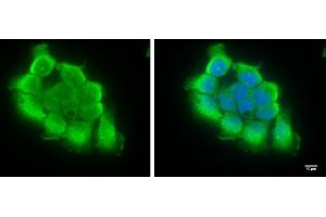 ICC/IF Image TRIF antibody [C3], C-term detects TRIF protein at cytosol by immunofluorescent analysis.