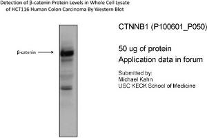 Image no. 4 for anti-Catenin (Cadherin-Associated Protein), beta 1, 88kDa (CTNNB1) (C-Term) antibody (ABIN2792527)