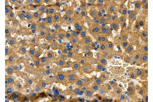 ABIN6257369 and ABIN6275406 at 1/100 staining Rat liver tissue by IHC-P. (NDRG4 anticorps  (Internal Region))