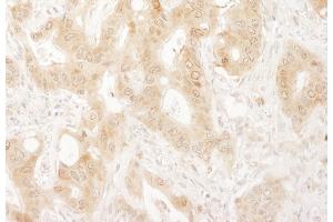 Immunohistochemistry (IHC) image for anti-Paxillin (PXN) (AA 1-50) antibody (ABIN7453855)