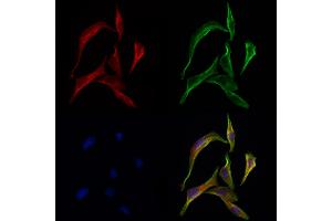 ABIN6259350 and ABIN6275567 staining 3 by IF/ICC. (SH3GLB2 anticorps  (C-Term))