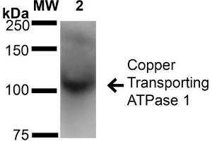 Western Blot analysis of Rat Brain Membrane showing detection of ~180 kDa Copper Transporting ATPase 1 protein using Mouse Anti-Copper Transporting ATPase 1 Monoclonal Antibody, Clone S60-4 . (ATP7A anticorps  (AA 42-61) (APC))