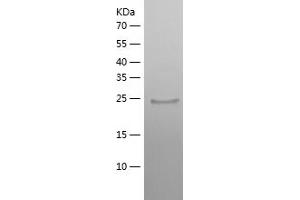 Western Blotting (WB) image for Zinc Finger Protein 10 (ZNF10) (AA 20-242) protein (His tag) (ABIN7125775) (ZNF10 Protein (AA 20-242) (His tag))