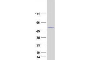 Validation with Western Blot