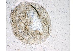 Anti-Calponin antibody, IHC(P) IHC(P): Human Placenta Tissue