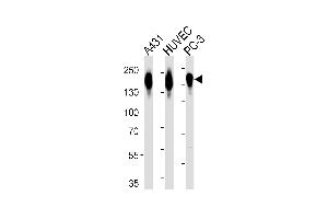 Western blot analysis of lysates from A431, HUVEC, PC-3 cell line (from left to right), using EGFR Antibody (p) (ABIN651628 and ABIN2840334). (EGFR anticorps  (C-Term))
