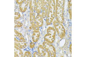 Immunohistochemistry of paraffin-embedded Mouse kidney using Parkin antibody  at dilution of 1:100 (40x lens). (Parkin anticorps  (AA 1-300))
