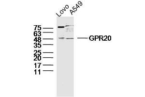 Lane 1: LOVO lysates Lane 2: A549 lysates probed with GPR20 Polyclonal Antibody, Unconjugated  at 1:300 dilution and 4˚C overnight incubation. (GPR20 anticorps  (AA 51-150))