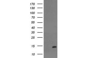 Image no. 1 for anti-TP53RK Binding Protein (TPRKB) antibody (ABIN1501485) (TPRKB anticorps)