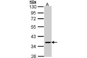 WB Image Sample (30 ug of whole cell lysate) A: Molt-4 , 10% SDS PAGE antibody diluted at 1:1000 (ATP6V1C2 anticorps  (Center))