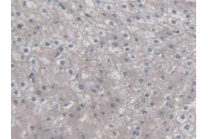 Detection of CXCL14 in Human Liver Tissue using Polyclonal Antibody to Chemokine (C-X-C Motif) Ligand 14 (CXCL14)