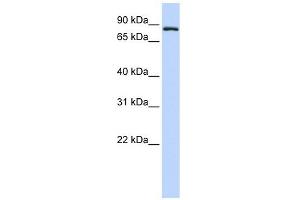 TFR2 antibody used at 1 ug/ml to detect target protein. (Transferrin Receptor 2 anticorps  (Middle Region))