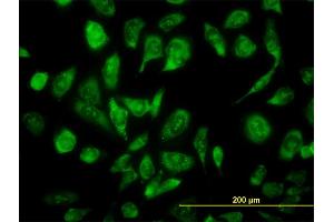 Immunofluorescence of monoclonal antibody to NCOA4 on HeLa cell. (NCOA4 anticorps  (AA 505-614))