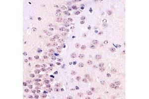 IHC testing of FFPE mouse brain tissue with TBP antibody at 1:25 dilution. (TBP anticorps)