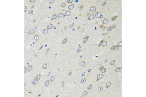 Immunohistochemistry of paraffin-embedded rat brain using OGDH antibody (ABIN6131413, ABIN6145002, ABIN6145004 and ABIN6216119) at dilution of 1:100 (40x lens). (alpha KGDHC anticorps  (AA 148-427))