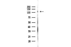 Western blot analysis of lysates from K562 cells(UV 30 min treatment), using  Antibody at 1/1000 dilution.