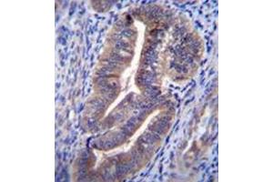 Immunohistochemistry analysis in formalin fixed and paraffin embedded human uterus tissue reacted with KIAA1324 / EIG121 Antibody (C-term) Cat.