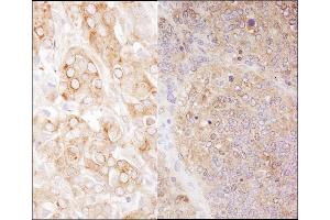 Immunohistochemistry (IHC) image for anti-Eukaryotic Translation Elongation Factor 2 (EEF2) (AA 808-858) antibody (ABIN7454538) (EEF2 anticorps  (AA 808-858))