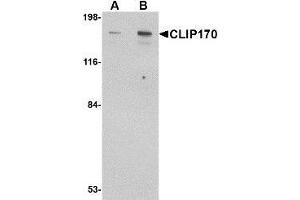 Western blot analysis of CLIP170 in rat brain tissue lysate with AP30238PU-N CLIP170 antibody at (A) 0. (CABS1 anticorps  (C-Term))