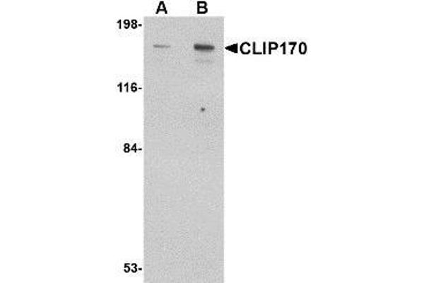 CABS1 antibody  (C-Term)