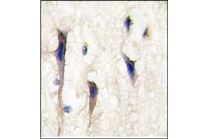 anti-Cdc42 Guanine Nucleotide Exchange Factor (GEF) 9 (Arhgef9) (Middle Region) antibody