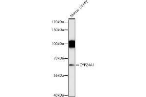 Western blot analysis of extracts of Mouse kidney, using CYP24 antibody (805) at 1:1000 dilution.
