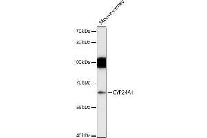 Western blot analysis of extracts of Mouse kidney, using CYP24 antibody (805) at 1:1000 dilution. (CYP24A1 anticorps  (AA 36-448))