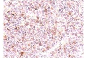 Immunohistochemistry (IHC) image for anti-Cyclin-Dependent Kinase Inhibitor 2D (p19, Inhibits CDK4) (CDKN2D) antibody (ABIN487338)