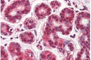 Human Breast (formalin-fixed, paraffin-embedded) stained with NR4A1 antibody ABIN337182 at 5 ug/ml followed by biotinylated anti-goat IgG secondary antibody ABIN481715, alkaline phosphatase-streptavidin and chromogen. (NR4A1 anticorps  (AA 401-414))
